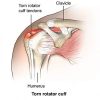Rotator-Cuff-Tendons-shoulder-pain